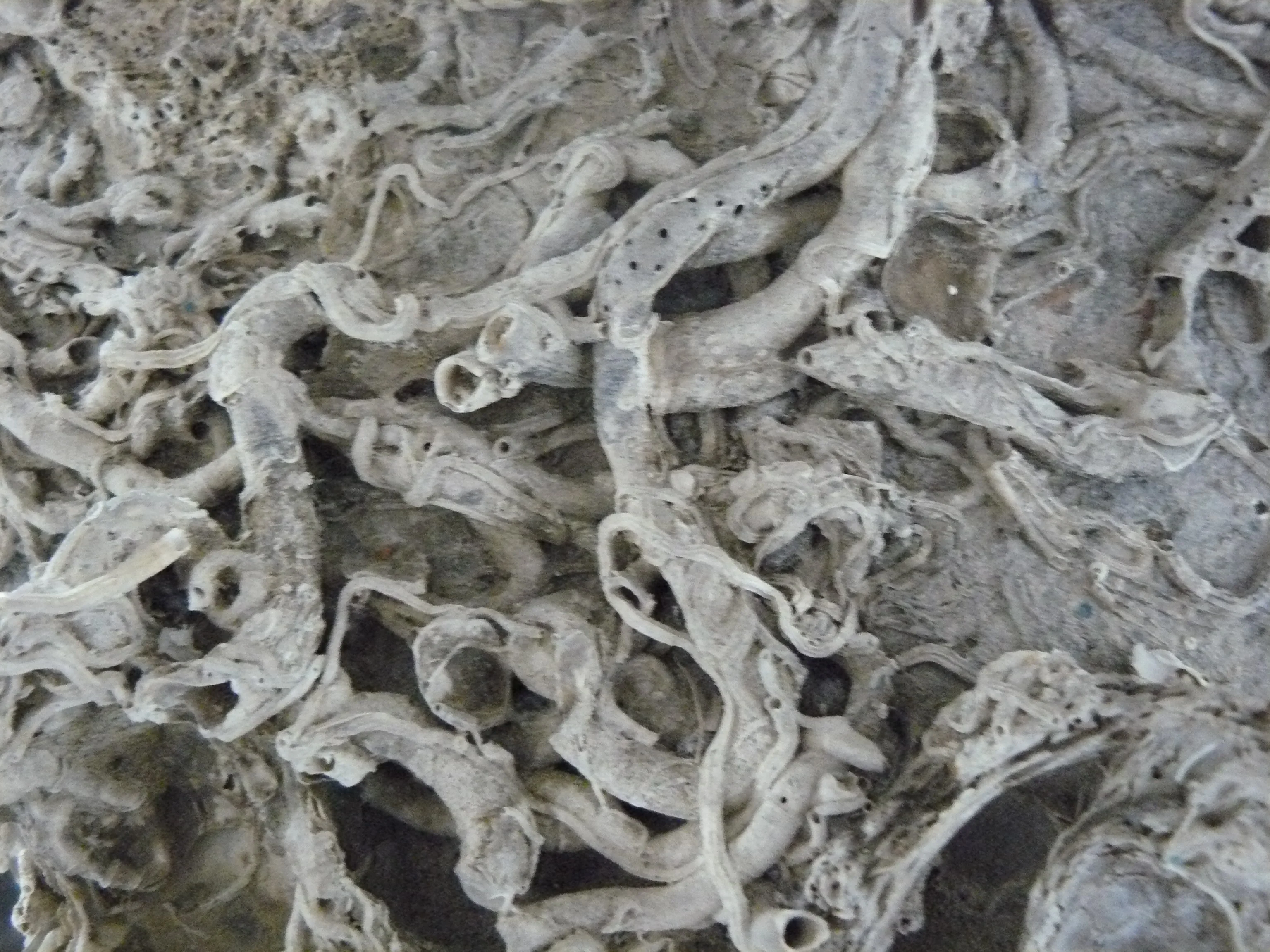 Calcification