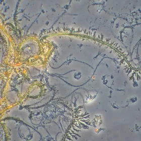 Iron oxidizing Leptothrix bacteria
