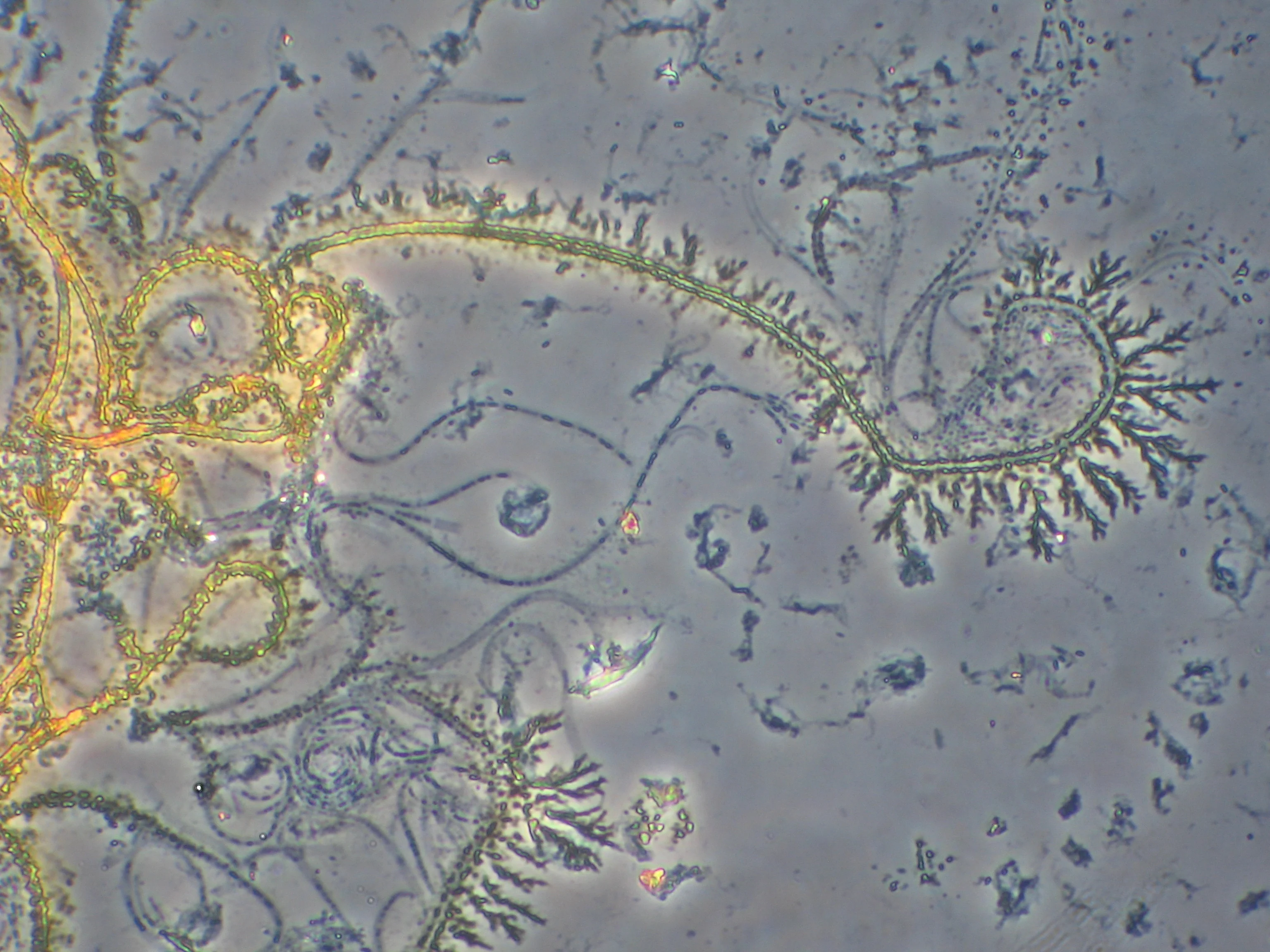 Iron oxidizing Leptothrix bacteria