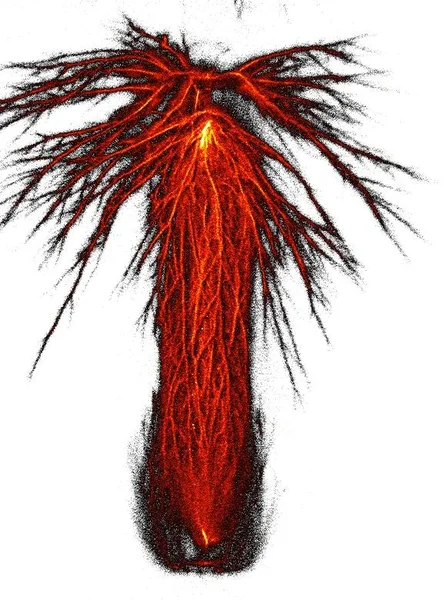 Negative discharge
