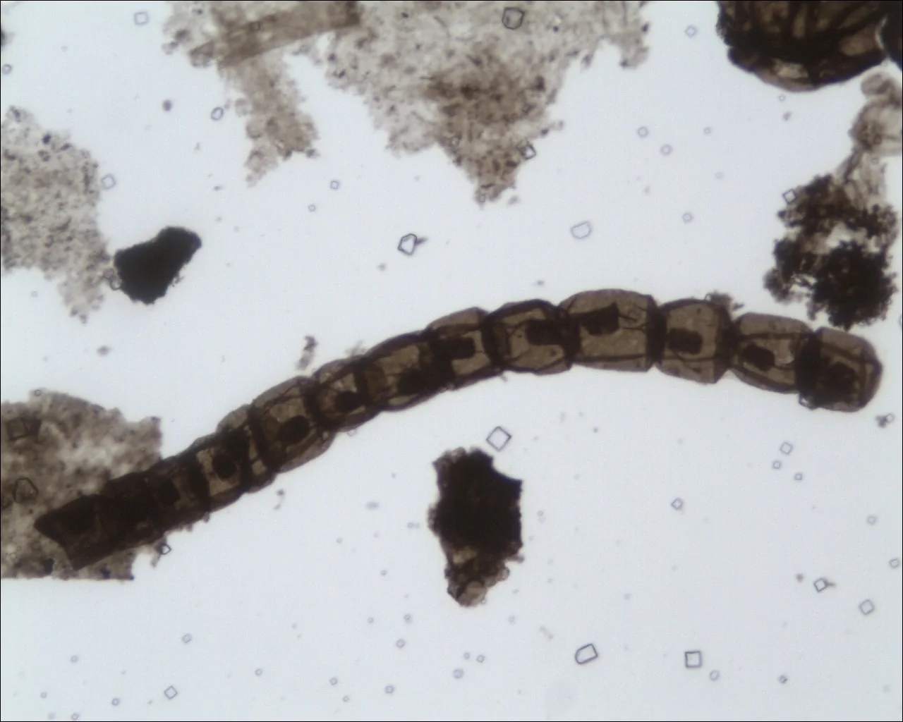 Artacellularia ellipsoida