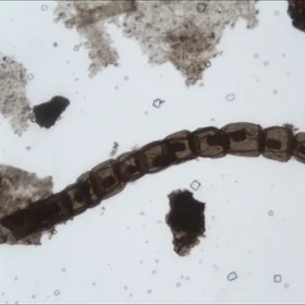 Artacellularia ellipsoida