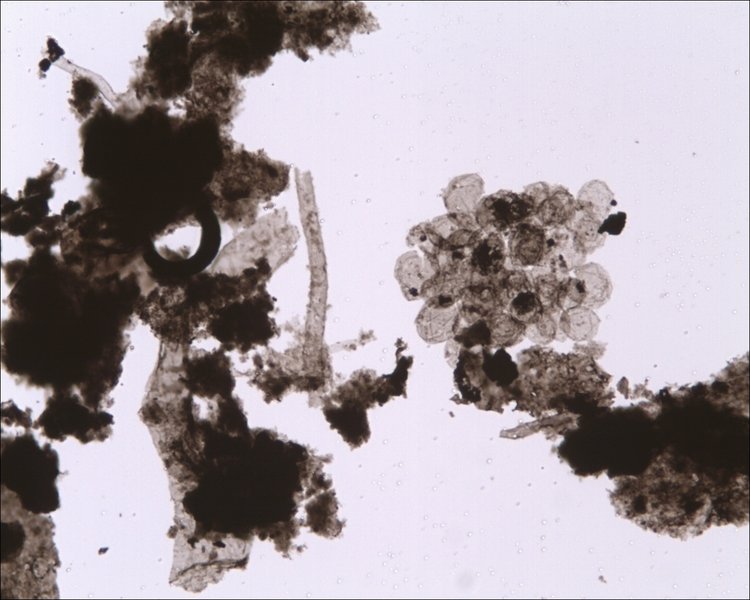 Synsphaeridium spp