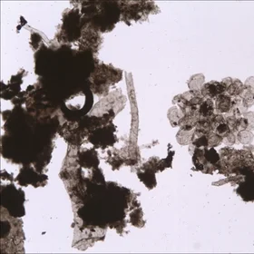 Synsphaeridium spp