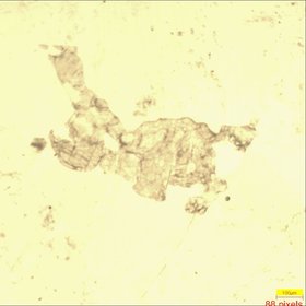 Plagioclases and pyroxens in a gabbro