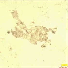 Plagioclases and pyroxens in a gabbro
