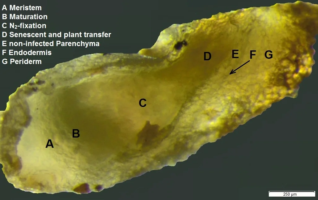 Longitudinal section of root nodules
