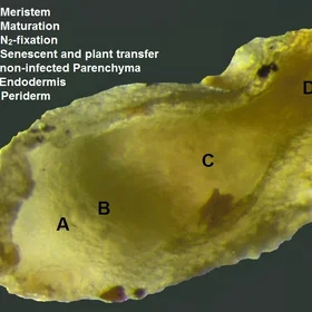 Longitudinal section of root nodules