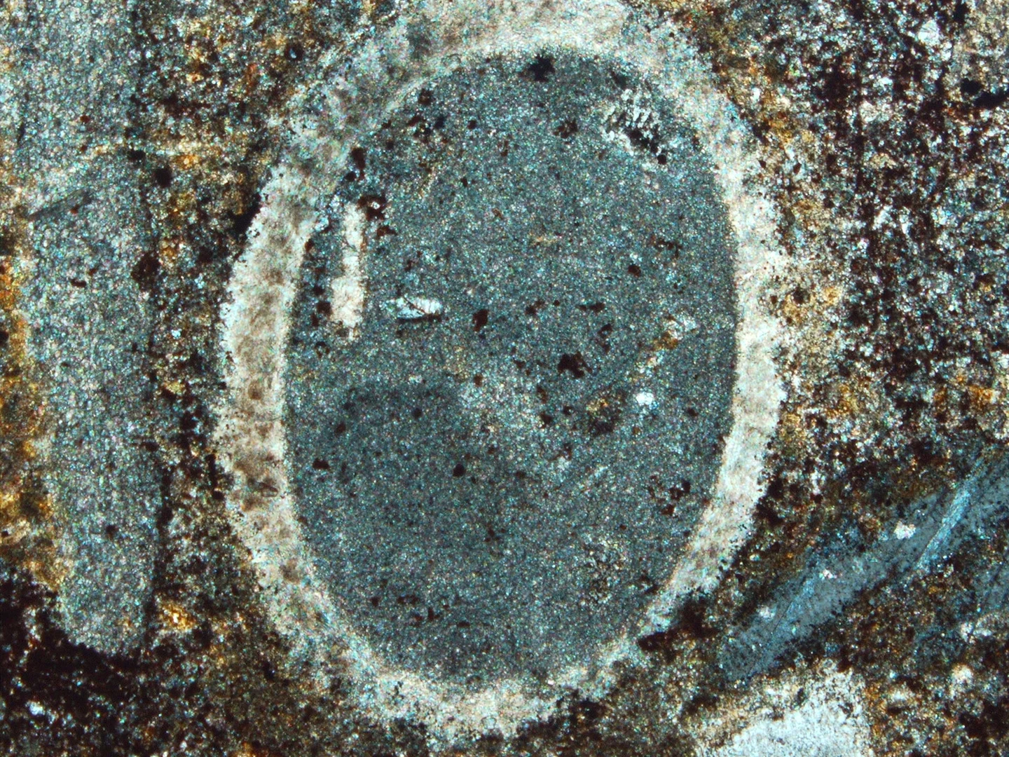 Echinoid shell