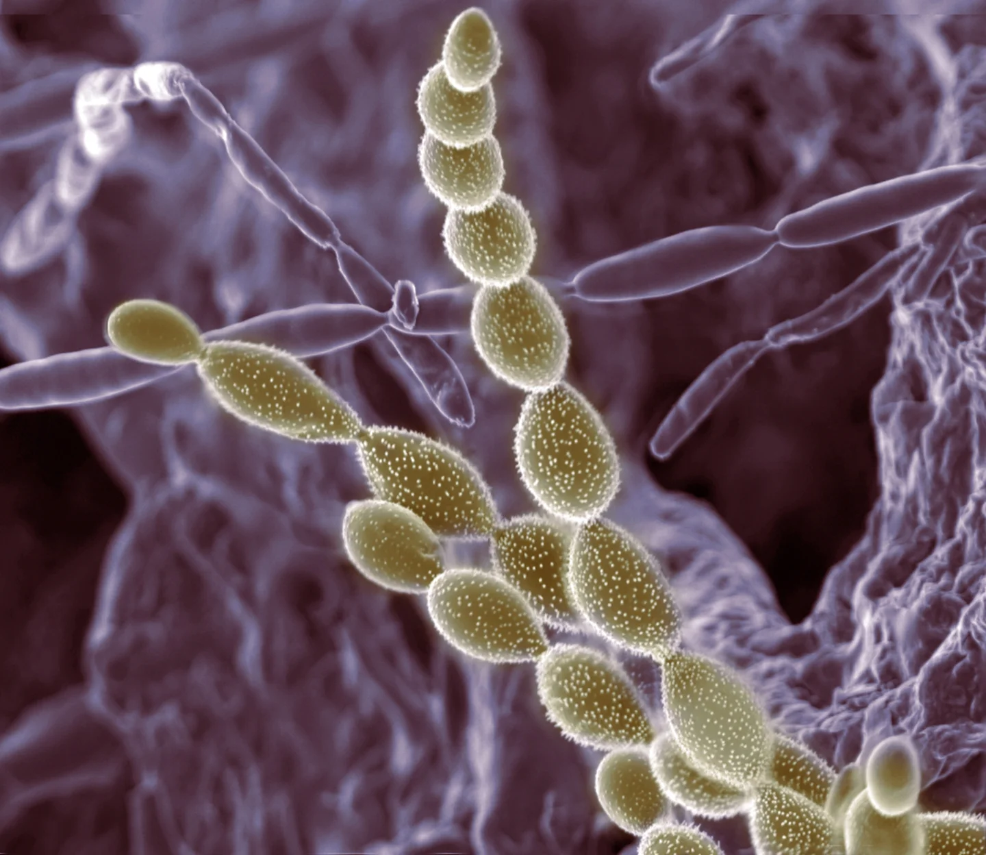 Soil microbes