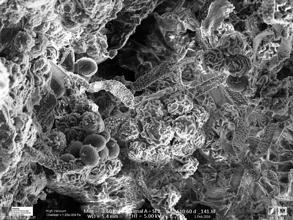 Mushroom hyphae in Vega soil