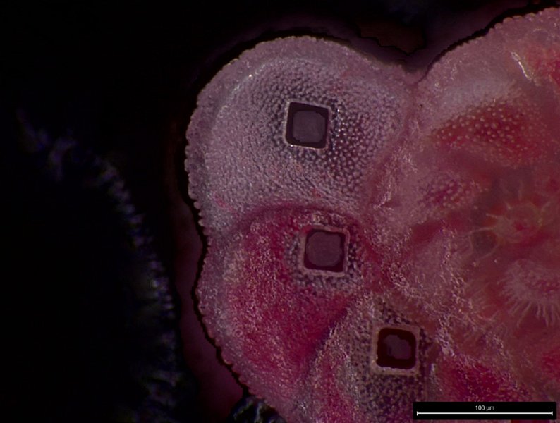 Ablated Pararotalia calcariformata (foraminifera)
