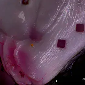 Ablated Lachlanella (foraminifera)