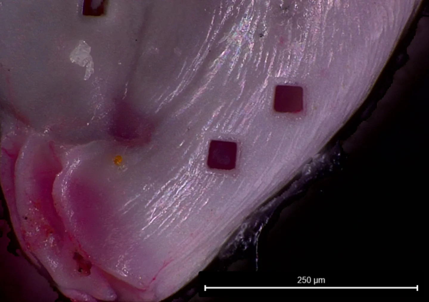 Ablated Lachlanella (foraminifera)
